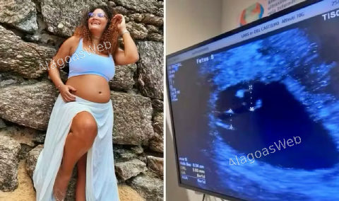 Jovem engravida de mais um bebê já estando grávida de gêmeos