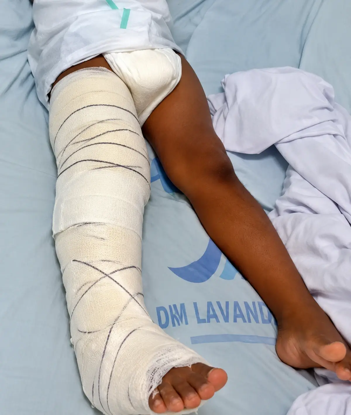 Criança de 2 anos é baleada durante atentado a tiros em Coruripe