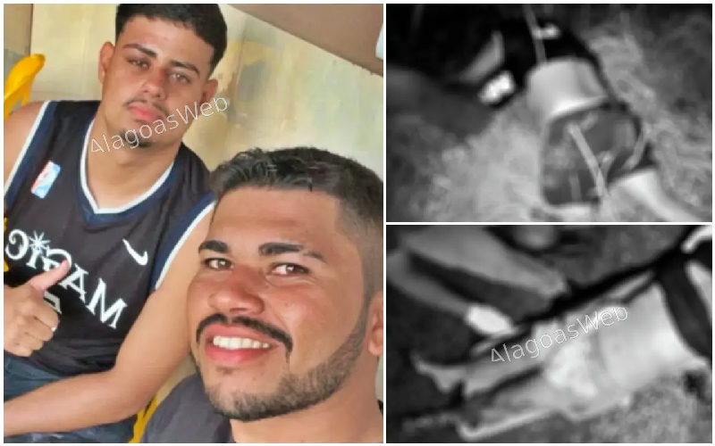 Jovem morre e outro fica gravemente ferido após colisão entre moto e carro na AL-215, em Boca da Mata